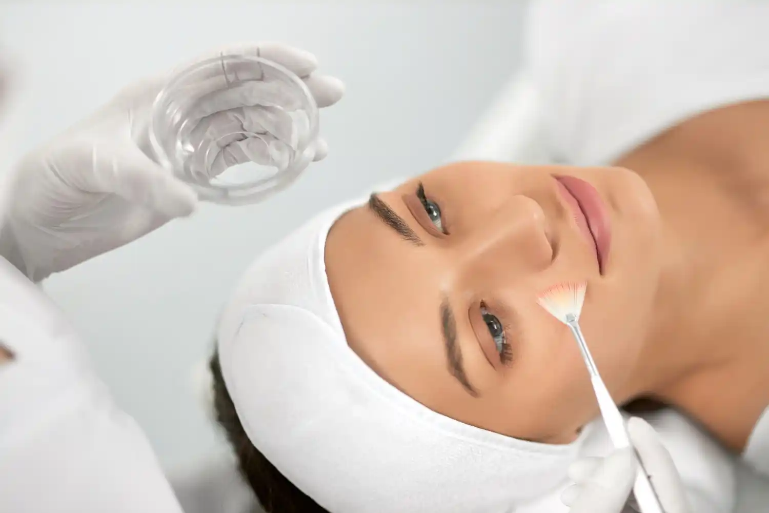 Chemical peeling merupakan treatment wajah yang dilakukan dengan cara pengelupasan sel-sel kulit mati